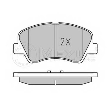 Колодки тормозные дисковые передний для KIA RIO(UB) <b>MEYLE 025 253 4818 / MBP1575</b>-1
